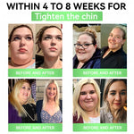 Charger l'image dans la galerie, đ„ Patch Alcurasâą Minceur & MĂ©tabolisme â 8 bienfaits Moringa Ă BerbĂ©rine Ă AMPK đșđž âš Une seule application par jour · Des changements visibles en 7 jours
