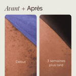 Charger l'image dans la galerie, Roll-on -Solution apaisante pour l'épilation dépilatoire, lotion hydratante
