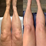 Charger l'image dans la galerie, Drainage lymphatique – Visage affiné, jambes allégées, ventre plat
