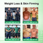 Charger l'image dans la galerie, 👩‍⚕️Alcuras™ Moringa × Berberine × AMPK 8-Benefit Slimming &amp; Metabolic Nano Microneedle Patch 🇺🇸  Just once a day · Visible changes in 7 days  ✅ For obesity, loose skin, diabetes, sleep apnea, joint issues, and more
