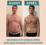 Charger l'image dans la galerie, Patch Minceur Détox™️
