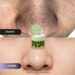 Charger l'image dans la galerie, JiYu Toning Polish Pads-Soin pour les taches brunes
