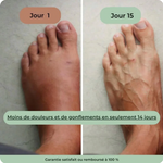 Charger l'image dans la galerie, Masseur Thérapeutique Anti-Douleur
