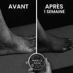 Charger l'image dans la galerie, Miracle Balm – Soulage varices, jambes lourdes, douleurs et brûlures aux pieds, neuropathie, dès la première application
