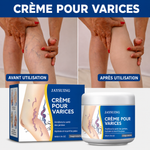 Charger l'image dans la galerie, Crème Anti Varices ✨
