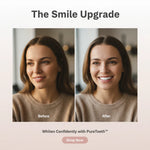 Charger l'image dans la galerie, PureTeeth™ - Transformez vos dents jaunes en un sourire de star en seulement 7 jours (+ bonus mystère GRATUIT)
