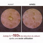 Charger l'image dans la galerie, DR.MELAXIN Peel Shot Duo- Ampoule exfoliante au riz noir Shot
