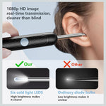 Charger l'image dans la galerie, Ear Wax Removal Kit with Camera
